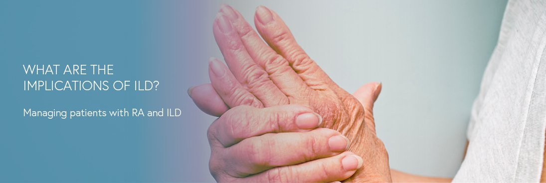 What are the implications of ILD?